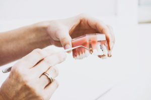 what are dental plants made of?